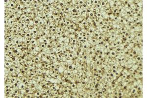 ABIN6273295 at 1/100 staining Mouse liver tissue by IHC-P. (PHF17 antibody  (C-Term))
