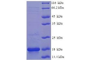 SDS-PAGE (SDS) image for Frataxin (FXN) (AA 81-210) protein (His tag) (ABIN4976693)