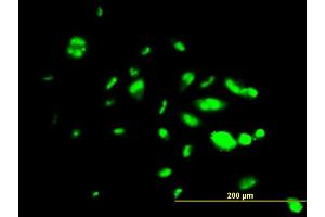 Immunofluorescence of monoclonal antibody to FOXA1 on HepG2 cell. (FOXA1 antibody  (AA 367-472))