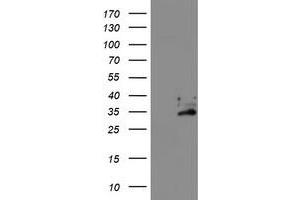 HEK293T cells were transfected with the pCMV6-ENTRY control (Left lane) or pCMV6-ENTRY EXOSC7 (Right lane) cDNA for 48 hrs and lysed. (EXOSC7 antibody)