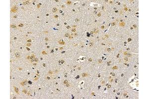 anti-Early Growth Response 4 (EGR4) antibody