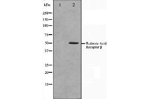 Western blot analysis on HepG2 cell lysate using Retinoic Acid Receptor beta Antibody,The lane on the left is treated with the antigen-specific peptide. (Retinoic Acid Receptor beta antibody  (Internal Region))