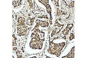 IHC analysis of SFPQ using anti-SFPQ antibody (ABIN7603089).