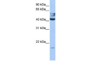 QTRT1 antibody used at 0. (QTRT1 antibody)
