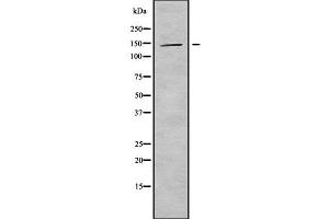 Western blot analysis of KIF4B using HepG2 whole cell lysates (KIF4B antibody  (C-Term))