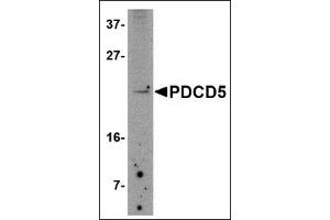 Western blot analysis of PDCD5 in Jurkat cell lysate with this product at 2. (PDCD5 antibody  (N-Term))