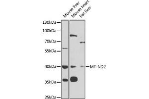 Western blot analysis of extracts of various cell lines, using MT-ND2 antibody (ABIN6135113, ABIN6144107, ABIN6144108 and ABIN6221773) at 1:1000 dilution. (MT-ND2 antibody  (AA 50-150))