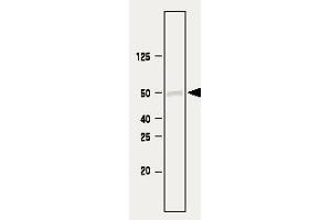 Immunoblot analysis. (SETD7 antibody)