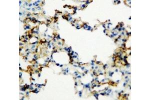 IHC-P: RAGE antibody testing of rat lung tissue