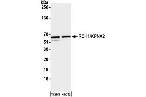 Western Blotting (WB) image for anti-Importin Subunit alpha-1 (KPNA2) (C-Term) antibody (ABIN7453571) (Importin Subunit alpha-1 (KPNA2) (C-Term) antibody)