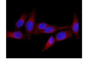 IF analysis of MID1 using anti-MID1 antibody (ABIN6719400). (MID1 antibody  (AA 226-278))