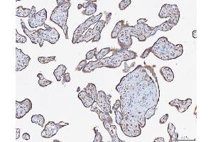 IHC analysis of ATX2/ATXN2 using anti-ATX2/ATXN2 antibody (ABIN3043507). (Ataxin 2 antibody  (C-Term))