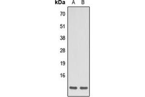 Western blot analysis of Apelin expression in HEK293T (A), HeLa (B) whole cell lysates. (Apelin antibody  (C-Term))
