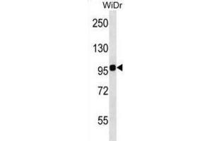 Western Blotting (WB) image for anti-Integrin beta 7 (ITGB7) antibody (ABIN2998522) (Integrin beta 7 antibody)