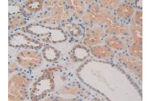 IHC-P analysis of Human Kidney Tissue, with DAB staining. (CACYBP antibody  (AA 2-228))