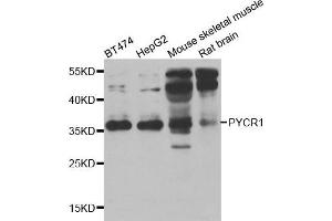 Western blot analysis of extracts of various cell lines, using PYCR1 antibody. (PYCR1 antibody)