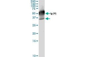 Immunoprecipitation of GALE transfected lysate using anti-GALE MaxPab rabbit polyclonal antibody and Protein A Magnetic Bead , and immunoblotted with GALE MaxPab rabbit polyclonal antibody (D01) . (GALE antibody  (AA 1-348))