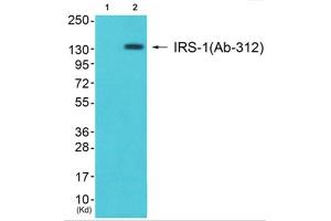 Western Blotting (WB) image for anti-Insulin Receptor Substrate 1 (IRS1) (Ser312) antibody (ABIN1848113) (IRS1 antibody  (Ser312))