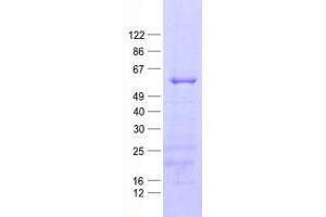 Validation with Western Blot (MMP20 Protein (His tag))