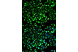 Immunofluorescence (IF) image for anti-Tryptase alpha/beta 1 (TPSAB1) antibody (ABIN1875186)