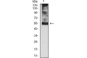 Western Blotting (WB) image for anti-Cyclin-Dependent Kinase Inhibitor 1C (p57, Kip2) (CDKN1C) antibody (ABIN7193626)