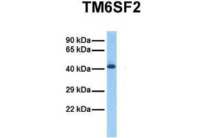 Host:  Rabbit  Target Name:  TM6SF2  Sample Tissue:  Human Fetal Liver  Antibody Dilution:  1. (TM6SF2 antibody  (C-Term))