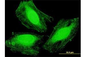 Immunofluorescence of purified MaxPab antibody to ARMC1 on HeLa cell. (ARMC1 antibody  (AA 1-282))
