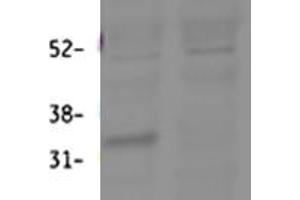 ABIN768641 (0. (HSD11B1 antibody  (Internal Region))