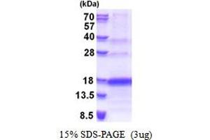 VEGF 121/VEGFA (AA 207-327) (Active) protein (His tag)