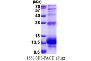 SDS-PAGE (SDS) image for Peptidase Inhibitor 3, Skin-Derived (PI3) (AA 23-117) protein (His tag) (ABIN5853134) (PI3 Protein (AA 23-117) (His tag))