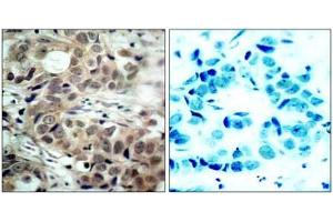 Image no. 1 for anti-Cell Division Cycle 25 Homolog C (S. Pombe) (CDC25C) (pSer216) antibody (ABIN196818) (CDC25C antibody  (pSer216))