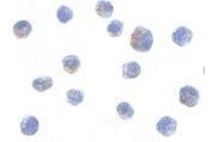 Immunocytochemistry of IKK alpha in Jurkat cells with AP30405PU-N IKK alpha antibody at 10 μg/ml. (IKK alpha antibody  (C-Term))