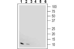 Western blot analysis with Anti-IGF1 antibody:1, 4.