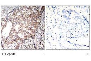 Image no. 1 for anti-SHC (Src Homology 2 Domain Containing) Transforming Protein 1 (SHC1) (pTyr427) antibody (ABIN197086) (SHC1 antibody  (pTyr427))