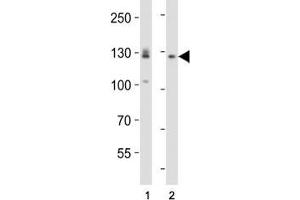 Western blot analysis of lysate from (1) A431 and (2) U-87 MG cell line using EPHA2 antibody diluted at 1:1000. (EPH Receptor A2 antibody  (AA 518-552))