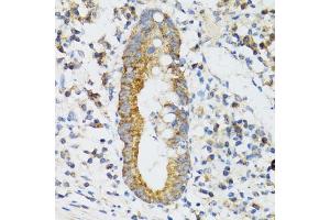 Immunohistochemistry of paraffin-embedded human vermiform appendix using SRP19 antibody (ABIN6129677, ABIN6148450, ABIN6148451 and ABIN6222484) at dilution of 1:100 (40x lens). (SRP19 antibody  (AA 1-144))