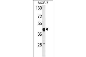 Western blot analysis of ETS2 Antibody in MCF-7 cell line lysates (35ug/lane) (ETS2 antibody  (AA 146-173))