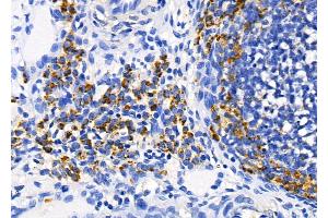 ABIN6259851 and ABIN6278727 at 1/100 staining Rat ovarian tissue by IHC-P.
