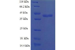 SDS-PAGE (SDS) image for Chemokine (C-C Motif) Ligand 25 (CCL25) (AA 24-150) protein (GST tag) (ABIN5709219)