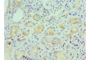 Immunohistochemistry of paraffin-embedded human kidney tissue using ABIN7156941 at dilution of 1:100 (IL-9 antibody  (AA 19-144))