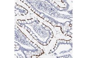 Immunohistochemical staining of human colon with VILL polyclonal antibody  shows strong luminal membrane positivity in glandular cells at 1:50-1:200 dilution.