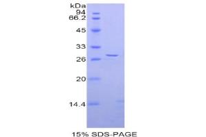 SDS-PAGE analysis of Rat ADAM5 Protein. (ADAM5 Protein)