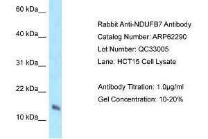 Western Blotting (WB) image for anti-NADH Dehydrogenase (Ubiquinone) 1 beta Subcomplex, 7, 18kDa (NDUFB7) (N-Term) antibody (ABIN2789101) (NDUFB7 antibody  (N-Term))
