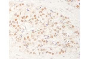 anti-Nuclear Receptor Binding Factor 2 (NRBF2) (AA 125-175) antibody