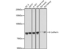 Western blot analysis of extracts of various cell lines, using E-Cadherin antibody  at 1:1000 dilution. (E-cadherin antibody  (AA 700-800))