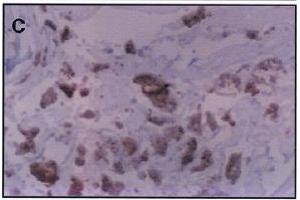 Immunohistochemistry image of dihydropyridine adduct staining in paraffn section of human atherosclerotic aorta. (Malondialdehyde antibody)