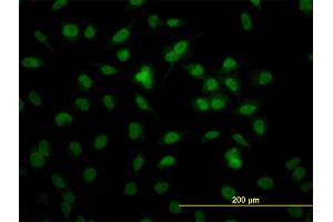 Immunofluorescence of monoclonal antibody to RBBP4 on HeLa cell. (Retinoblastoma Binding Protein 4 antibody  (AA 316-426))