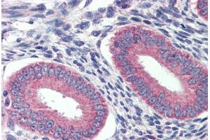 Human Prostate: Formalin-Fixed, Paraffin-Embedded (FFPE) (GRHL2 antibody  (C-Term))