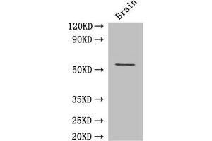 Western Blot Positive WB detected in: Mouse brain tissue All lanes: ASH2L antibody at 3 μg/mL Secondary Goat polyclonal to rabbit IgG at 1/50000 dilution Predicted band size: 69, 57, 61 kDa Observed band size: 69 kDa (ASH2L antibody  (AA 1-534))
