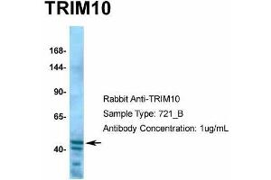Human Hela; Host: Rabbit. (TRIM10 antibody  (C-Term))